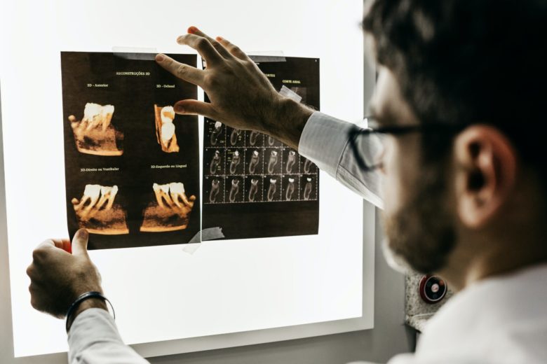 doctor examining patients x-ray image